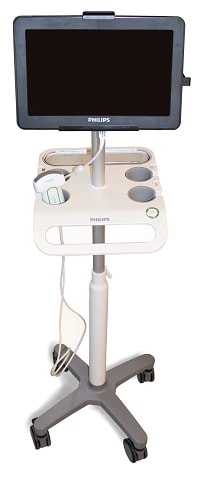 Philips VISIQ portable ultrasound system